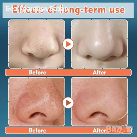 Нови Носови Лепенки за Почистване на Пори – Черни Точки, Всички Кожи, снимка 2 - Други - 50655368