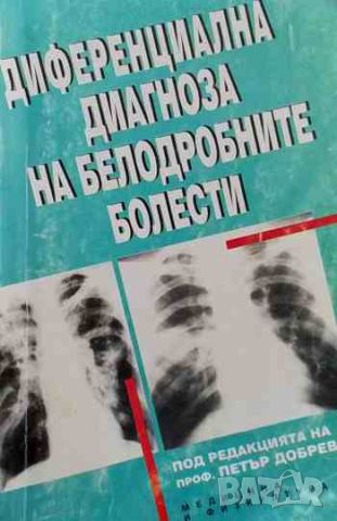 Диференциална диагноза на белодробните болести, снимка 1 - Специализирана литература - 46626902