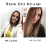 Комплект за бърз растеж на косата, косопад, оплешивяване, Bio Rehab промоция, снимка 3