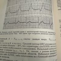 Електрокардиографичен атлас -А.Чернов, снимка 7 - Специализирана литература - 45316485