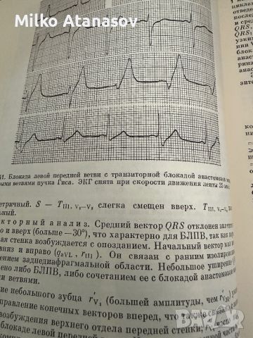 Електрокардиографичен атлас -А.Чернов, снимка 7 - Специализирана литература - 45316485