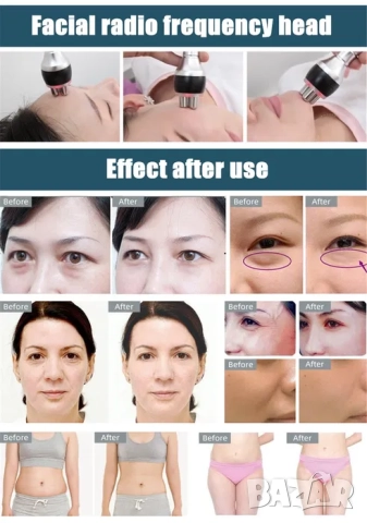 Уред за кавитация, вакуум и радиочестотен лифтинг 5 В 1 за отслабване, стягане на кожата, снимка 8 - Козметични уреди - 52062035