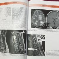 Множествена склероза - визуален справочник / Multiple Sclerosis - Visual Guide for Clinicians, снимка 8 - Специализирана литература - 45667994