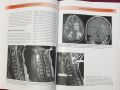 Множествена склероза - визуален справочник / Multiple Sclerosis - Visual Guide for Clinicians, снимка 8