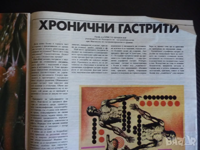 Здраве 3/86 Тайните на мозъка смущения лактация хронични гастрити морковити предпазно подкрепително , снимка 7 - Списания и комикси - 51133914