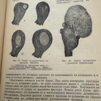 Гинекология-Илия Щъркалев,1964,стр.115, снимка 9 - Специализирана литература - 45385027