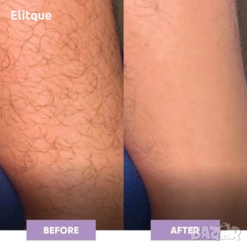 Компактен кристален уред за премахване на излишното окосмяване , снимка 10 - Други - 52796081