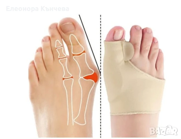 Ортопедични чорапи