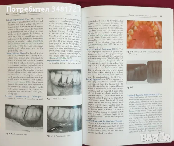 Енциклопедия на пародонтологията / Concise Encyclopedia of Periodontology, снимка 4 - Специализирана литература - 47018253