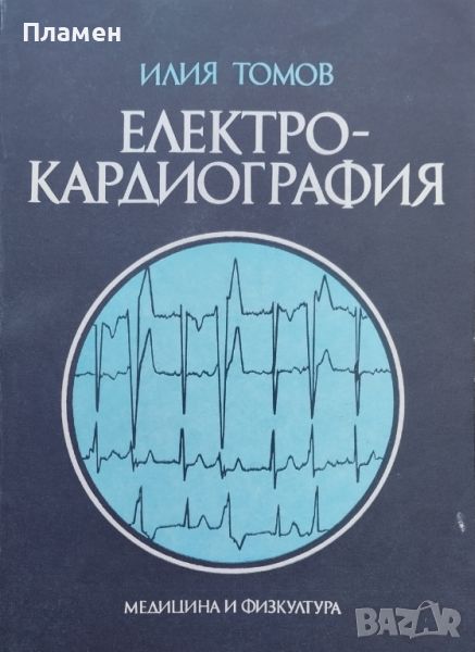 Електрокардиография Илия Томов, снимка 1
