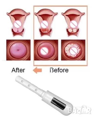 LowLevel Laser Therapy Light Treatment Gynecologic Therapeutic Apparatus Vaginal Tighten NonInvasive, снимка 13 - Други - 48407072