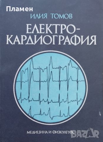Електрокардиография Илия Томов