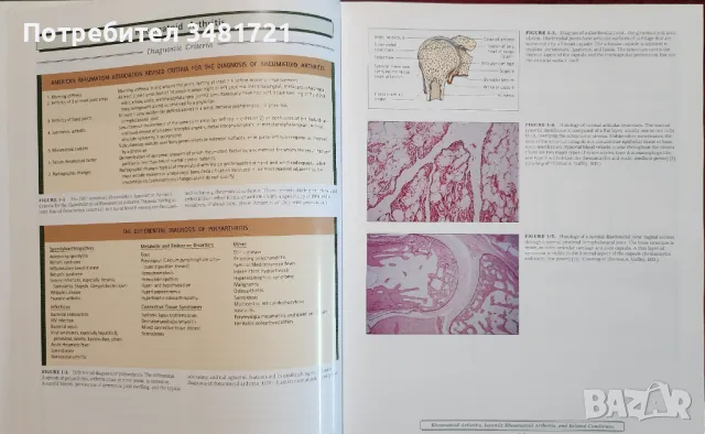 Атлас по ревматология / Atlas of Rheumatology, снимка 5 - Специализирана литература - 48775106