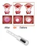 LowLevel Laser Therapy Light Treatment Gynecologic Therapeutic Apparatus Vaginal Tighten NonInvasive, снимка 13