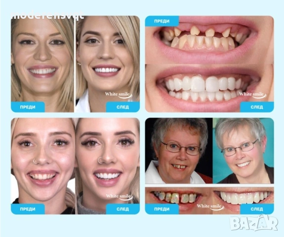 Изкуствени зъби WhiteSmile, снимка 4 - Други - 53658381