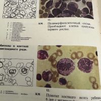 Болезни крови у детей -Атлас, снимка 7 - Специализирана литература - 45300488