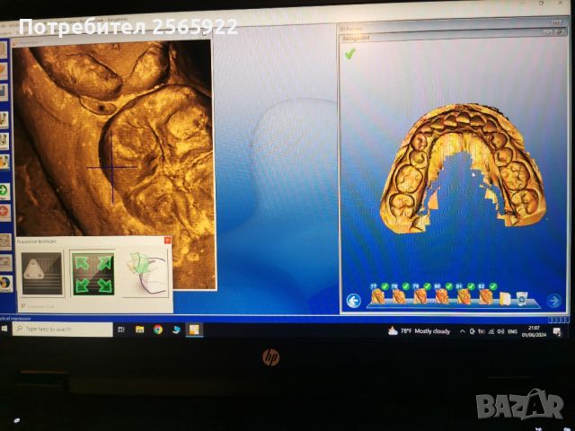 Зъботехнически скенер Sirona ineos blue , снимка 2 - Лаборатория - 45975141