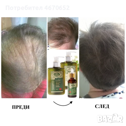 Коледен комплект за коса Bio Rehab