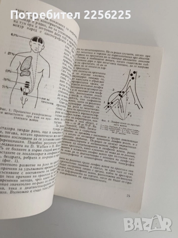 Рак на простатата, снимка 7 - Специализирана литература - 52913652