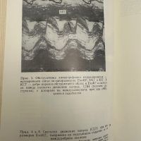 Кардиомиопатии-Е.Маламов,К.Чичовски, снимка 9 - Специализирана литература - 45252364