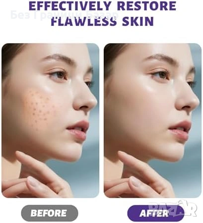 Нов Крем против акне 20g – локално третиране на пъпки и черни точки, контрол на омазняването , снимка 5 - Други - 53391176