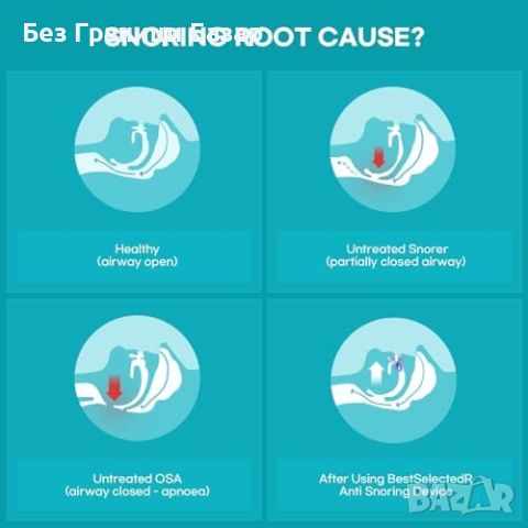 Нов Регулируем Ефективен антихъркащ уред за комфортен сън здраве, снимка 5 - Други - 46604822