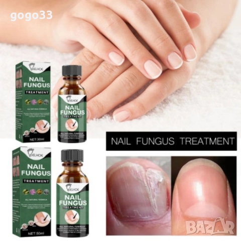 лак против гъбички , снимка 7 - Други - 51861216