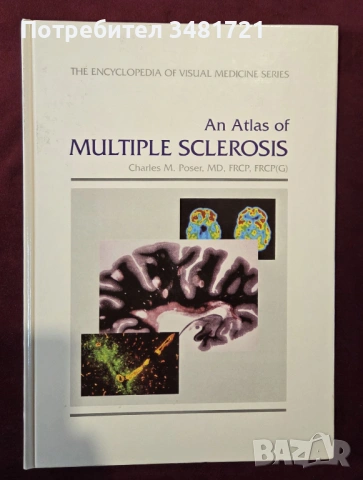 Голям атлас на множествената склероза / An Atlas of Multiple Sclerosis