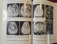 Голям атлас на множествената склероза / An Atlas of Multiple Sclerosis, снимка 14