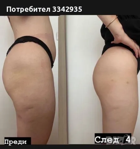 Машина за отслабване фитнес embody ems sculpting отслабване, снимка 6 - Фитнес уреди - 49733056