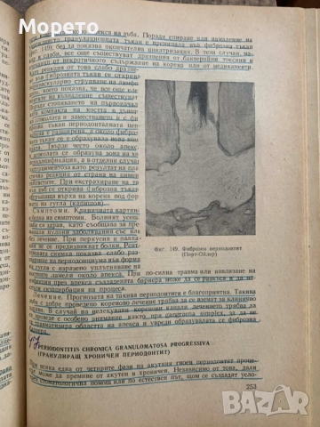 Терапевтична стоматология-Димитър Свраков, снимка 9 - Специализирана литература - 52863831