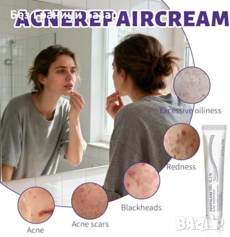Нов Крем против акне 20g – локално третиране на пъпки и черни точки, контрол на омазняването , снимка 6 - Други - 53391176