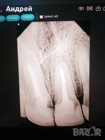 Дентален рантген и визиограф- нов, снимка 1 - Стоматология - 47539180