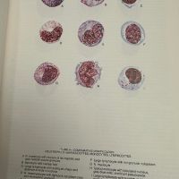 Хематологичен Атлас-The Morphology of Human Blood Cells-Abbot laboratories,1985,p.92, снимка 8 - Специализирана литература - 45372137