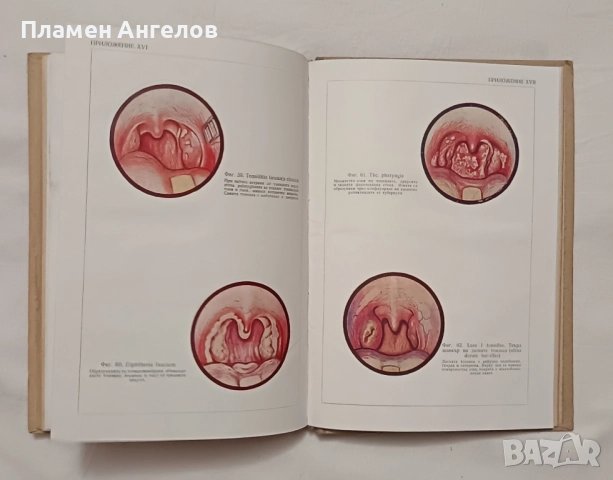 Учебник по Уши, носни и гърлени болести. , снимка 6 - Специализирана литература - 52182429