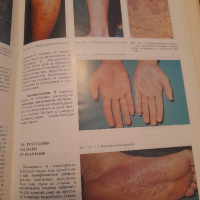 Атлас по кожни болести, снимка 6 - Специализирана литература - 44958324