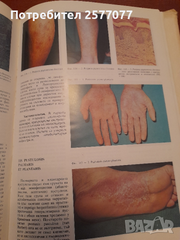 Атлас по кожни болести, снимка 6 - Специализирана литература - 44958324