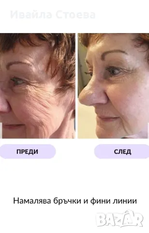 LED Маска за лице - Lumina Glow, снимка 8 - Козметични уреди - 50280678