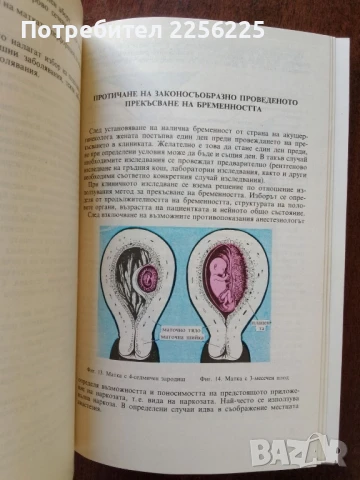 Желание за дете, снимка 9 - Специализирана литература - 50625500