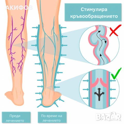 Апарат за венозна тренировка и облекчение на тежестта в краката, снимка 5 - Стенни часовници - 51886777
