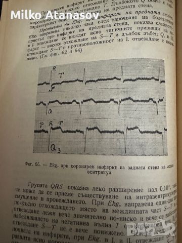 Електрокардиография и векторграфия на сърдечните заболявания -Вл.Буйклийски,1947,стр.125, снимка 9 - Специализирана литература - 45321484