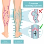 Апарат за венозна тренировка и облекчение на тежестта в краката, снимка 5