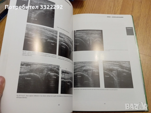 АTLAS D'ECHOGRAPHIQUE DU SYSTEME LOCOMOTEUR, снимка 2 - Художествена литература - 52791291