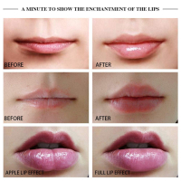 Устройство за уголемяване на устните, снимка 5 - Други - 44950383