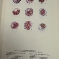 Хематологичен Атлас-The Morphology of Human Blood Cells-Abbot laboratories,1985,p.92, снимка 7 - Специализирана литература - 45372137