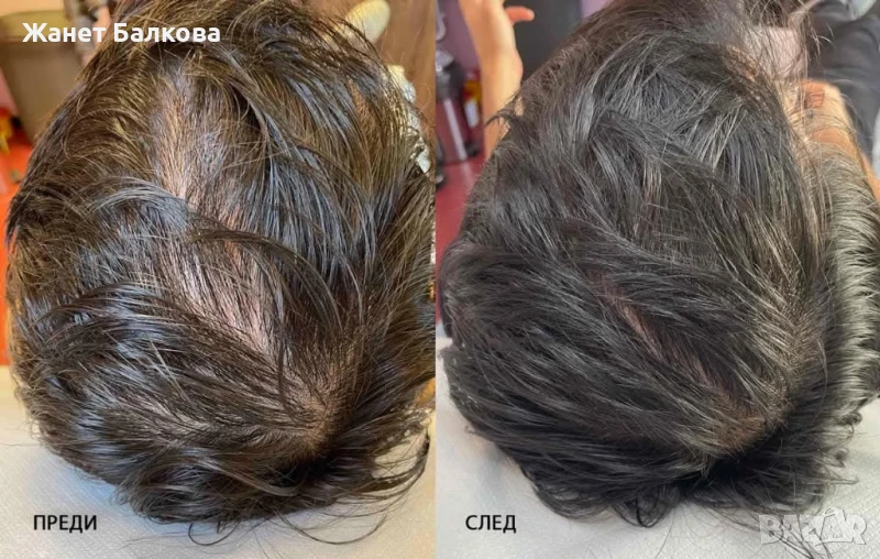 Тоник активатор на растежа "Bio Rehab" , снимка 1