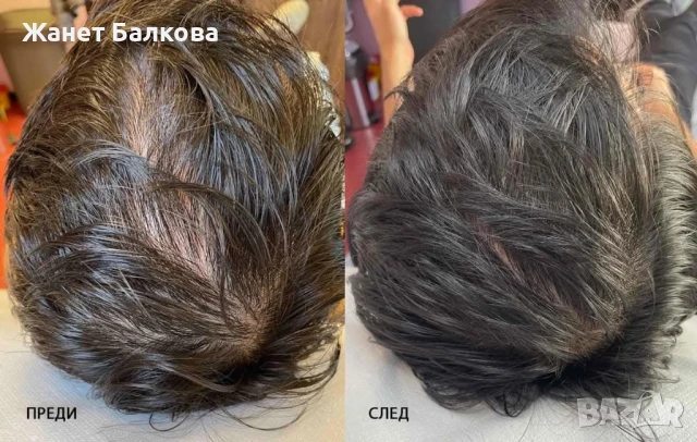 Тоник активатор на растежа "Bio Rehab" , снимка 1