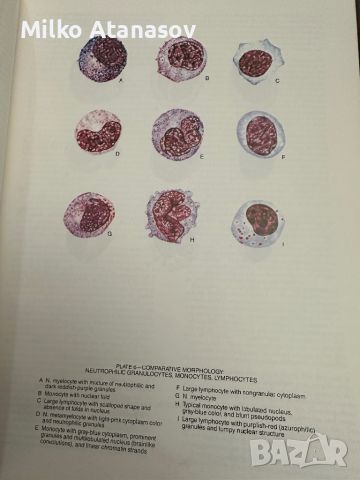 Хематологичен Атлас-The Morphology of Human Blood Cells-Abbot laboratories,1985,p.92, снимка 7 - Специализирана литература - 45372137