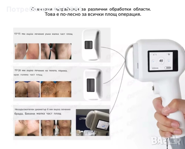 Диодна лазерна машина за епилация, снимка 2 - Козметични уреди - 52357100