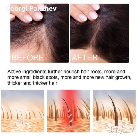 Многофункционален продукт за коса – растеж, заздравяване и сгъстяване, снимка 3 - Продукти за коса - 45919588